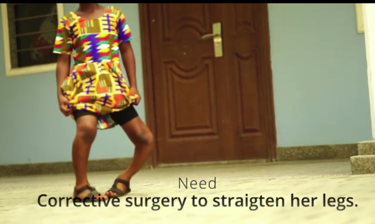 Emmanuella's Recovery Through Corrective Surgery
