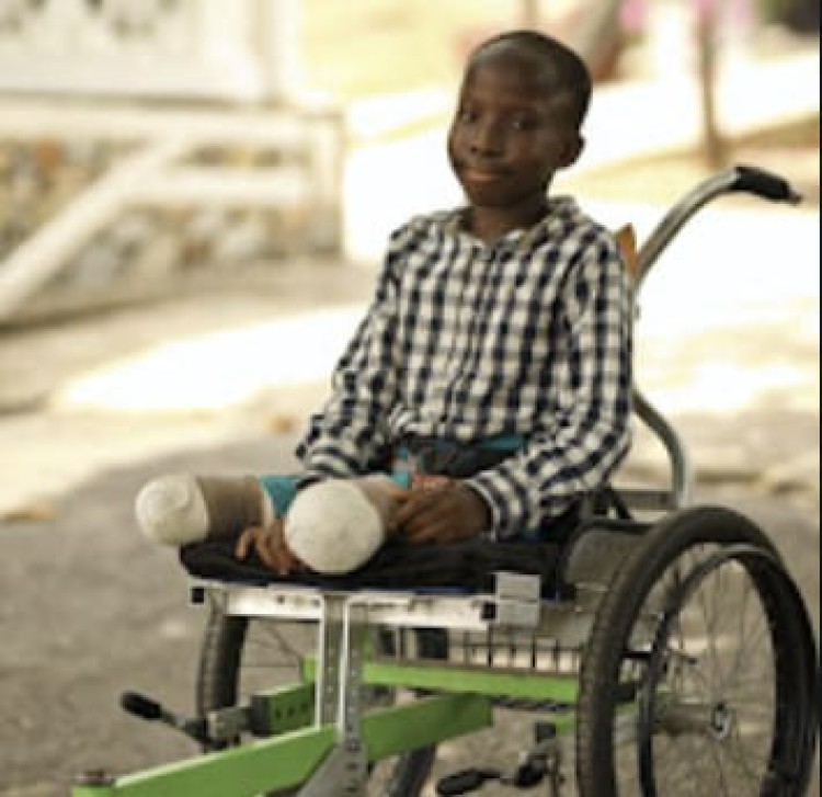 Life After Bilateral Amputation: John's Journey