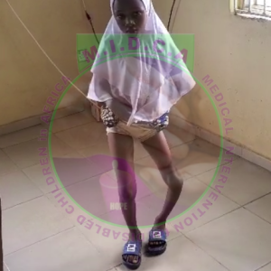 Isiaka Deformed leg