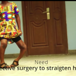 Emmanuella's Recovery Through Corrective Surgery
