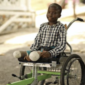 Life After Bilateral Amputation: John's Journey