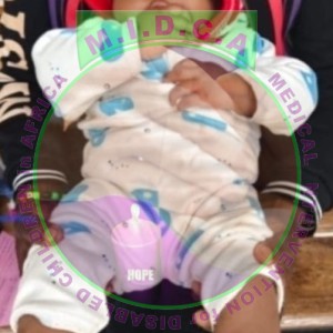 Little Abigael Club Feet